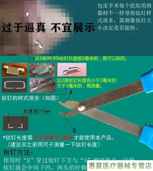 包皮钛钉取钉器手术后拆钉器吻合器皮肤缝合起钉器