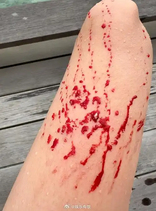 陈浩民老婆浮潜受伤