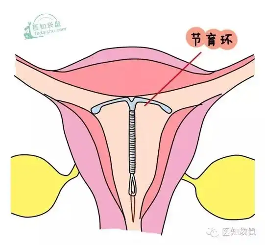 产后避孕方法大盘点,看哪种最安全? - 知识手册 - 妈妈帮百科