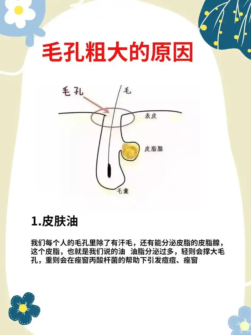 毛孔粗大❓快来看看你中招以下问题没❓.毛孔粗大真的是一个绕不
