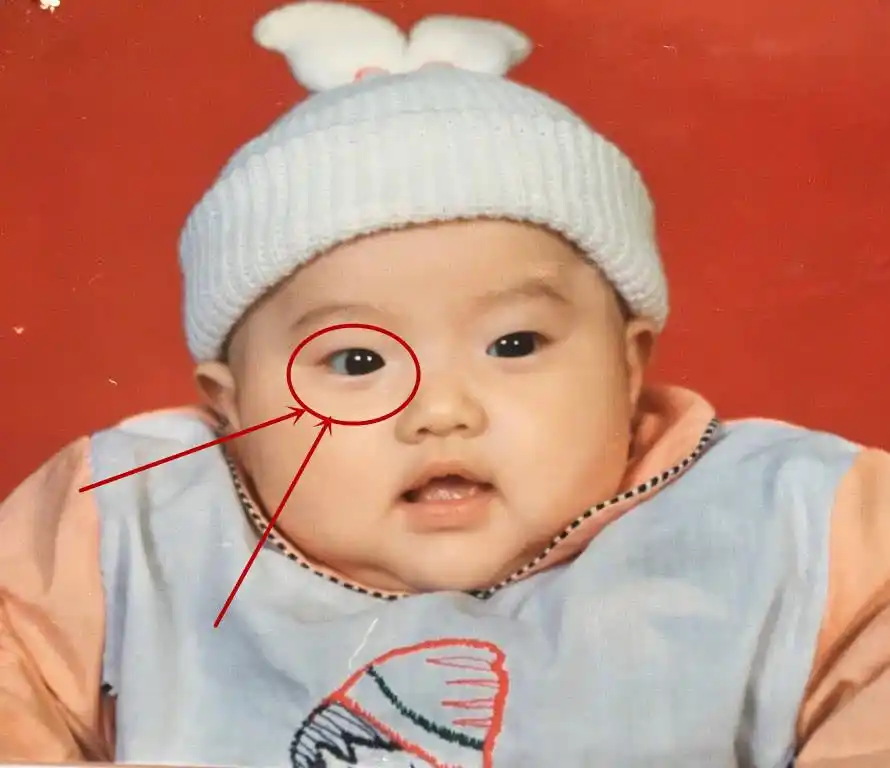 景甜六一晒童年照,小眼睛格外抢镜,网友:这双眼皮是割的吧!