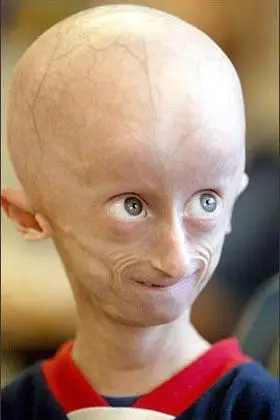 世界上最黑的孩子受质疑 盘点世界之最完全被震惊!