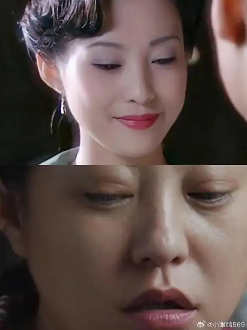 郝蕾这个痕迹怎么变深了,难道又割了71  年轻的时候她的双眼皮很浅