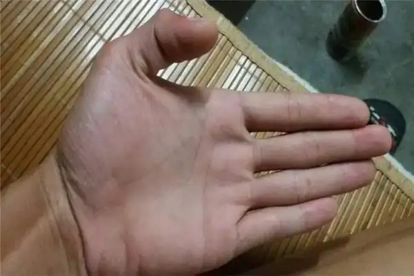 凤眼纹小的跟大的区别有哪些 凤眼纹清晰则人身体健康