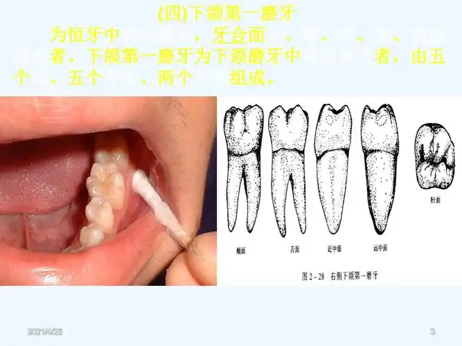 口腔下颌磨牙解剖形态精品课件