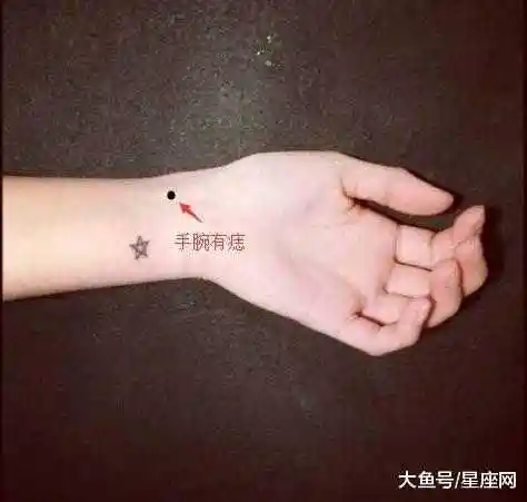 第三,手腕长痣.