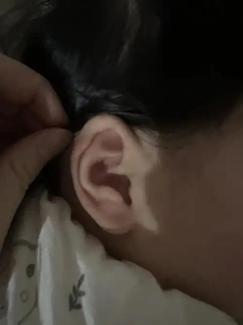 一只耳朵长开了一只耳朵还是扁的也不知