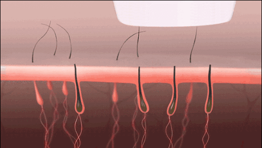 把杨幂顶上热搜把富豪搞没命发际线你可真牛昂