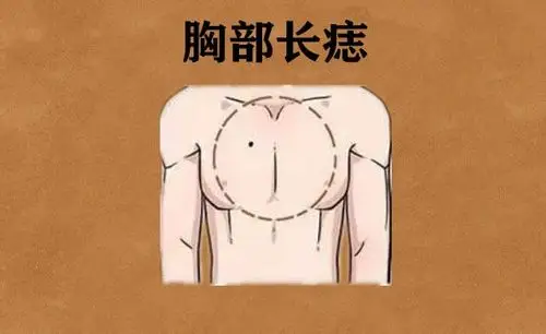 进财痣,身体此处长吉痣,正财稳定,横财暴涨,钱财哗哗来!