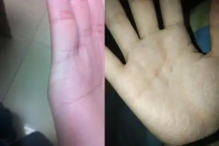 【图】婚姻线断开代表着什么 为你分析你的爱情运