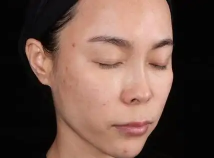 皮肤状态老不好多半是吃撑了肌断食让你7天就能拥有牛奶肌