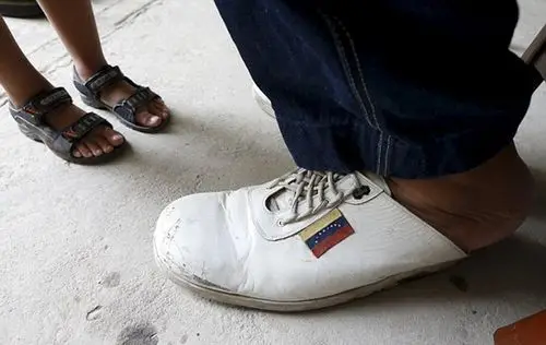 委内瑞拉男子拥有40厘米大脚打破世界纪录