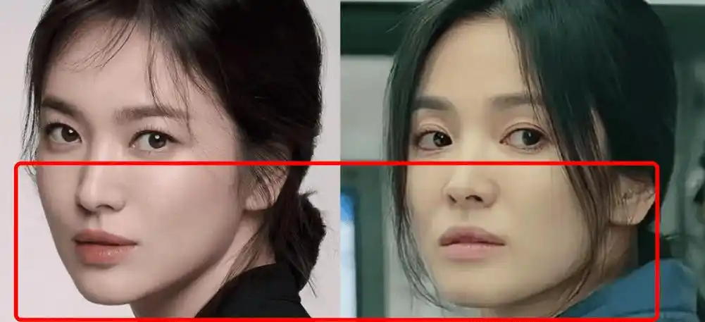 明星上了年纪后不只是她我们可以观察到她的瘪嘴感很明显尤其是说话的