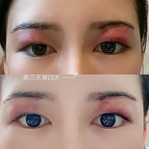 切眉1一7天的图片_小红书