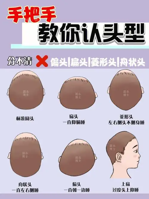 宝宝头型如何辨别头型71手把手教82快收藏