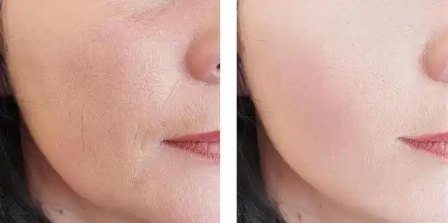 不过是一些皮肤上的小问题,容易让人烦恼,但因为缺乏正确的认识和处理