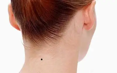 靠山痣与苦情痣的区别,靠山痣在哪个部位?