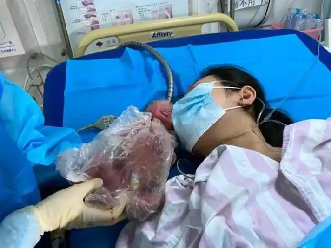 孕妇不幸流产 24天后竟又生了一个娃