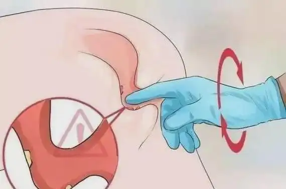 肛门指检这这辈子都不想做了