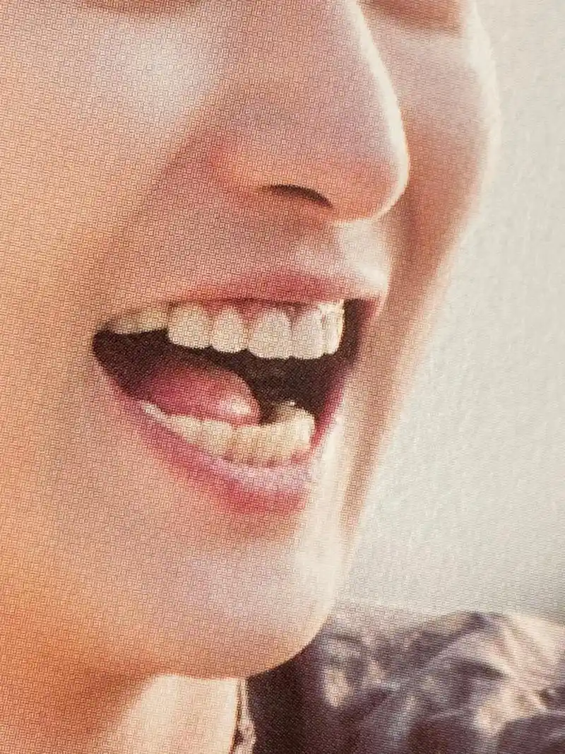 咧咧的金牙.#exo #朴灿烈 发现咧咧的金牙了👍#努力去