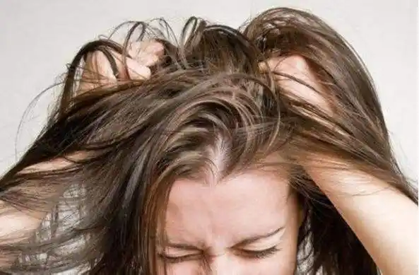 头皮屑,头皮瘙痒同时出现怎么办?