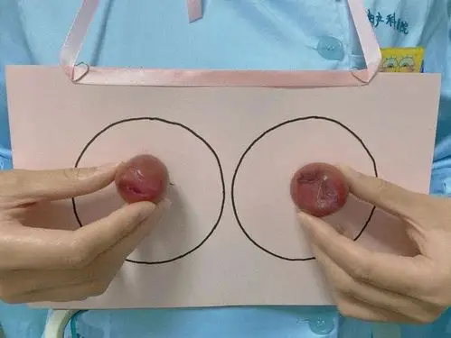 别羞羞,所有女人都该学会"自摸"|乳腺|肿块|乳头|活检|乳腺癌_网易