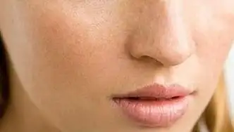 这些原因会造成皮肤粗糙 你是否有中招