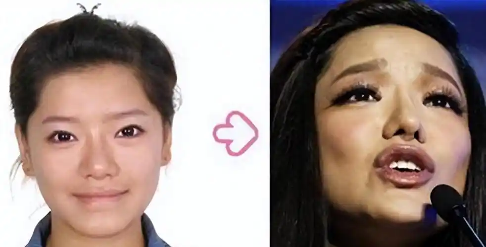 昔日超女冠军江映蓉整容失败后淡出娱乐圈现复出依旧无望