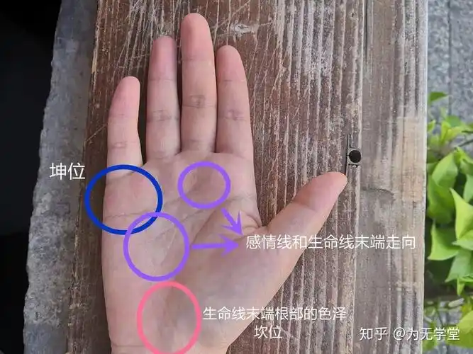 胡师总结子宫肌瘤的手诊表现有以下四种:1.生命线末端根部的色泽2.