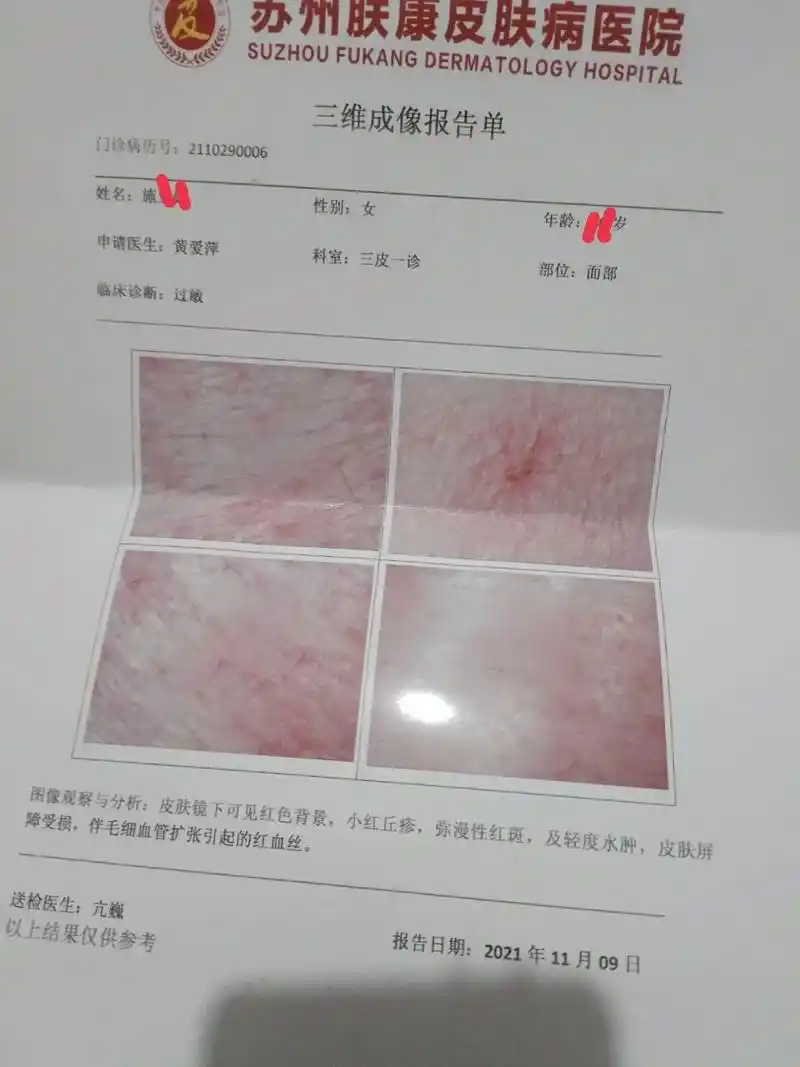 谜小妹 #素颜水 因为自己的皮肤问题,去年2021.11月 - 抖音