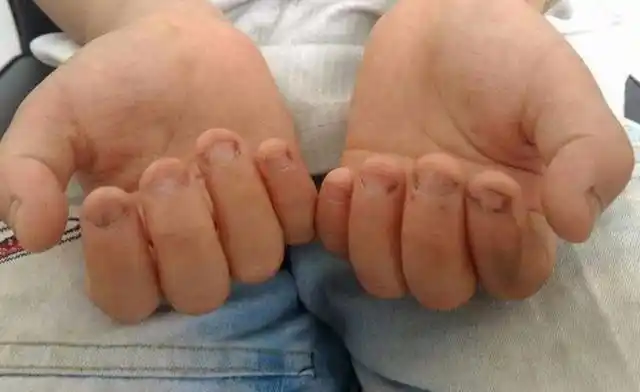 从小习惯"咬指甲"的孩子,现在都啥样了?逃不开3种结局