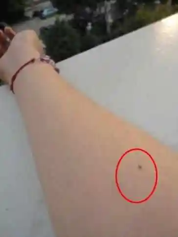 手中痣相有这些黑痣,不能多,有一个就能让你事业有成