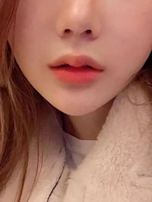 这是第二次玻尿酸打嘟嘟唇了,第一次的时候医生就有推_圈子-新氧美容