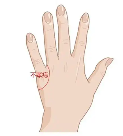 手背这7个地方有痣不一定全都好