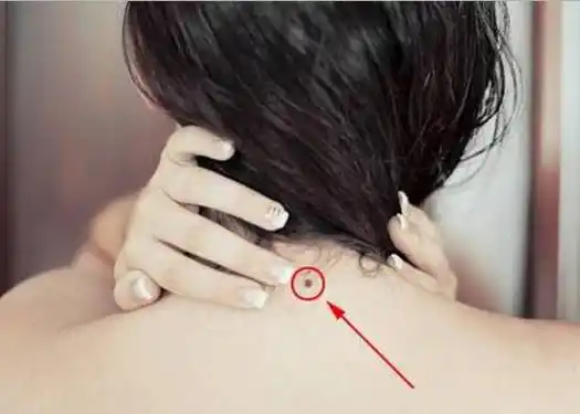 苦情痣是什么意思呢苦情痣的人财运好不易婚变