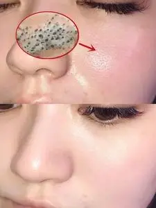 按摩膏清洁毛孔污垢脏东西面部疏通堵塞深层清理脸部皮肤霜排毒