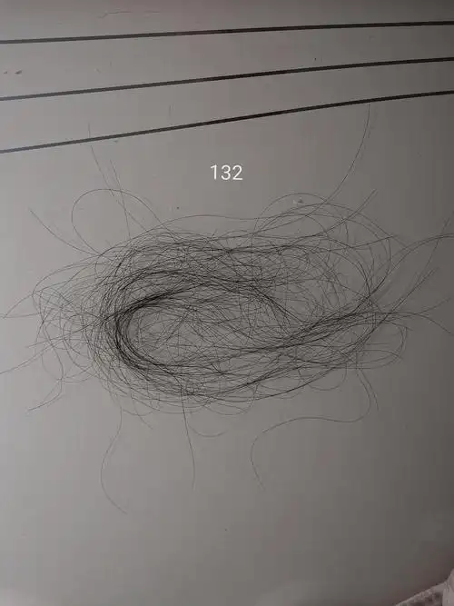 (帮忙看)洗头发脱发这么多正常吗?会洗秃吗?