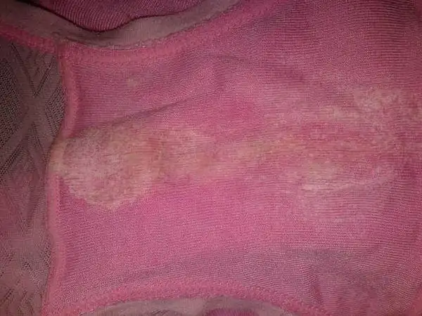 请问这些分泌物是什么?