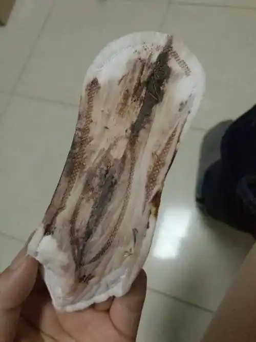 去医院查医生说是排卵期出血,可是每个人都有排卵期出血真的好难受啊