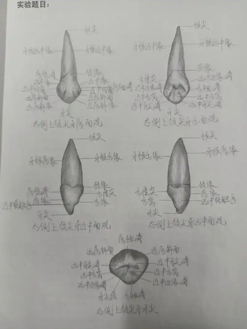 第二弹 口腔解剖生理学尖牙 上次发了中切牙,这次又有了新作业尖牙