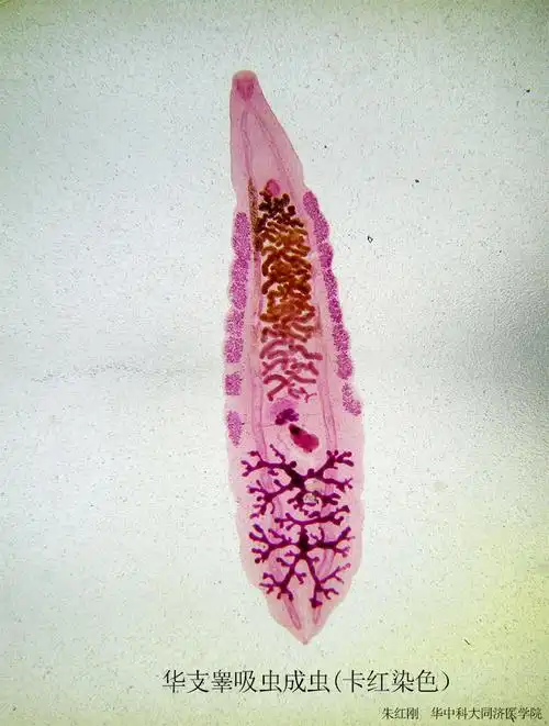 肝吸虫,肺吸虫,姜片虫和肝片形吸虫-吸虫(上)【形态看看