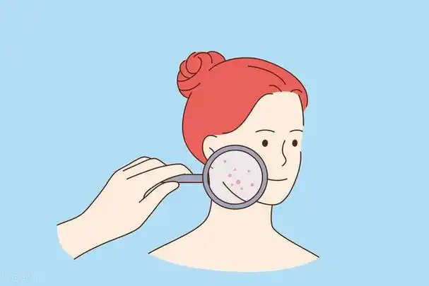 皮肤爱出油是什么原因?如何改善"大油田"?