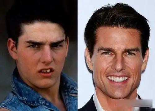 细数因牙齿变丑明星 女星几乎都整过牙(组图)