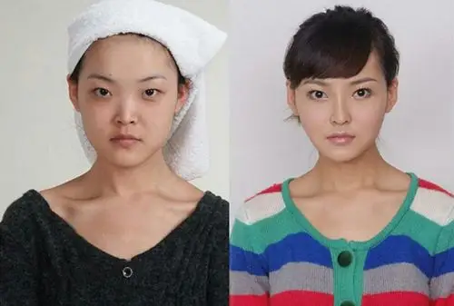 多名女子公布整容前后照片