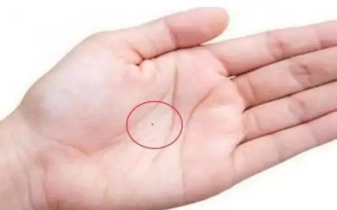 女人身上有这4颗痣,注定财星高照,谁娶谁发达