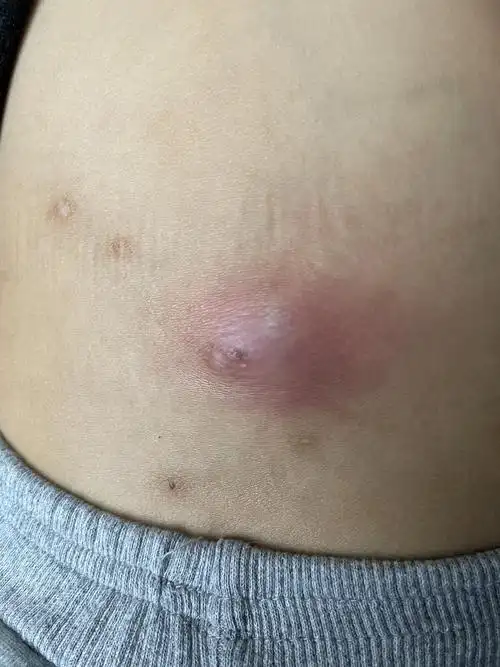 该图片可能引起不适继续查看