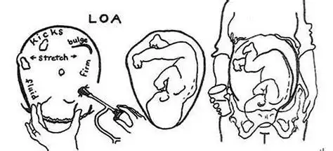 胎儿入盆是什么体验