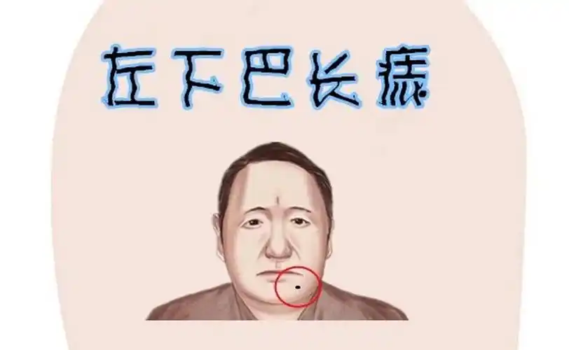 下巴底下长痣的男人(下巴底下长痣的男人代表什么)