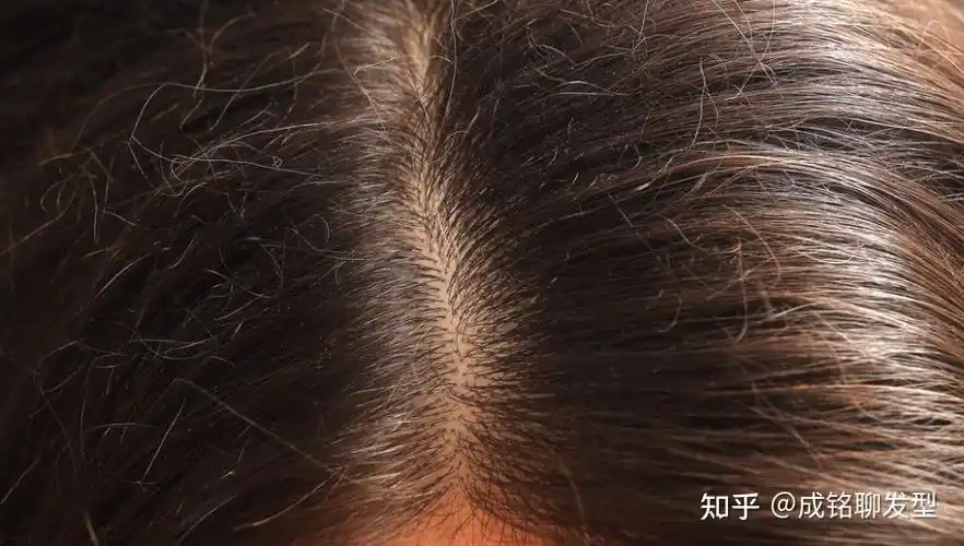 头发是从发根长还是从发梢长头发掉了还会长出来吗