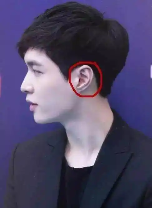 他的耳朵非常薄,并且非常瘦,导致耳骨同样十分突出.